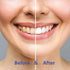 CHOMP Super Whitening Cool Fruit NHAP Toothpaste Tablets